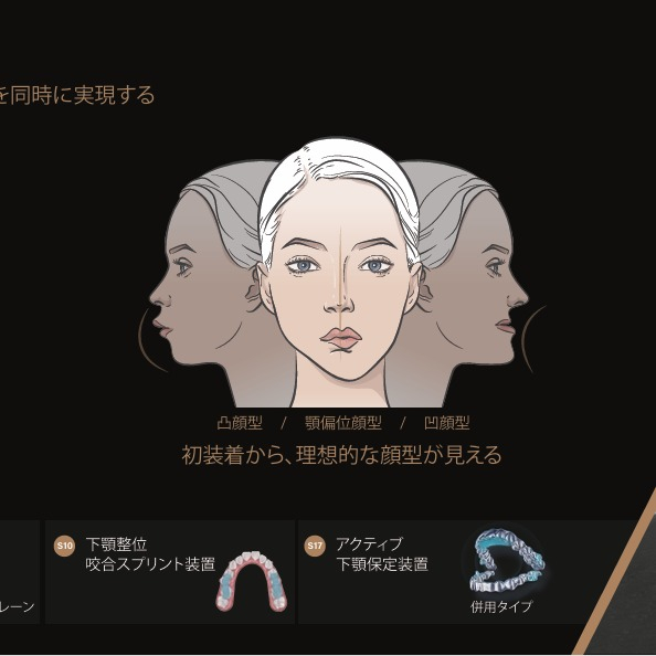 熱海市にあるみと歯科・矯正歯科では、最新のアライナー矯正技術